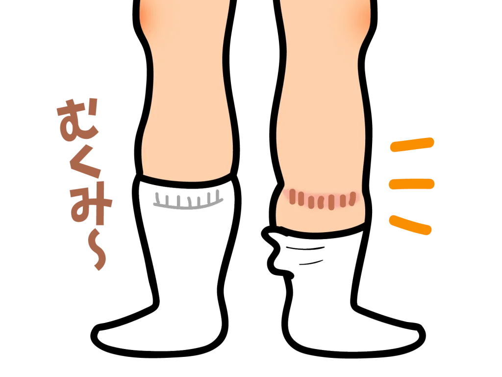 22701049 | QUALITAS(クオリタス)|痩身エステ付きパーソナルジム むくんだ足